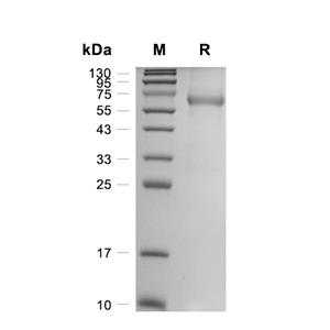 DKK-3蛋白, Mouse (HEK293, His)