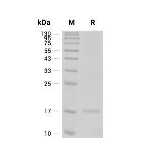 Dengue virus Capsid蛋白 (His)