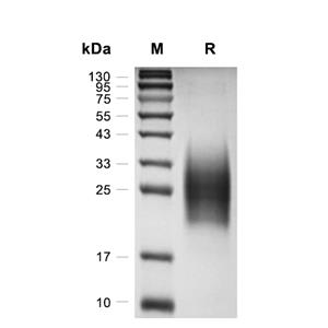 CD79蛋白, Mouse (HEK293, His),CD79 Protein, Mouse (HEK293, His)