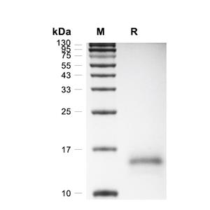 CD59蛋白, Rat (HEK293, His)