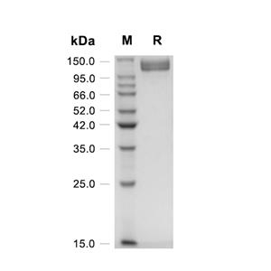 CD26/Dipeptidyl Peptidase 4蛋白, Mouse (HEK293, Fc)