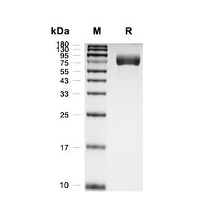 CD1B蛋白, Human (HEK293, Fc)
