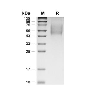 CD19蛋白, Cynomolgus/Rhesus Macaque (HEK293, His)