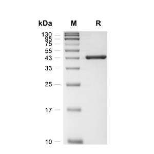 Carboxypeptidase A2/CPA2蛋白, Rat (HEK293, His),Carboxypeptidase A2/CPA2 Protein, Rat (HEK293, His)