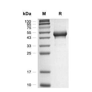 Carbonic Anhydrase 9蛋白, Canine (HEK293, His)