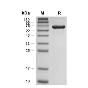 Calnexin蛋白, Mouse (HEK293, His),Calnexin Protein, Mouse (HEK293, His)