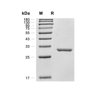 C1orf33/MRTO4蛋白, Human (His)