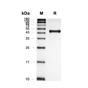 ACVR1蛋白, Rat (HEK293, hFc)