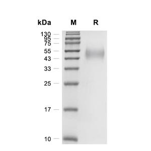 Allergin-1蛋白, Human (HEK293, His)