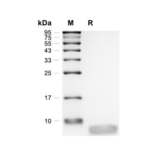 ATOX1蛋白, Human (His)