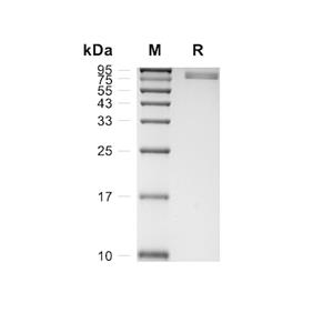 CD93/C1qR1蛋白, Rat (HEK293, His)