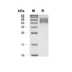 IL-17RD蛋白, Canine (HEK293, His)