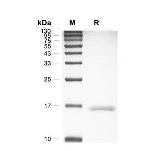 KIAA0101蛋白, Human (His)