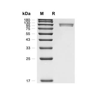LILRB3/CD85a蛋白, Human (HEK293, Fc)