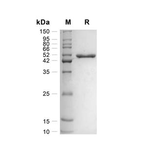 PNLIP/Pancreatic lipase蛋白, Human (HEK293, His)