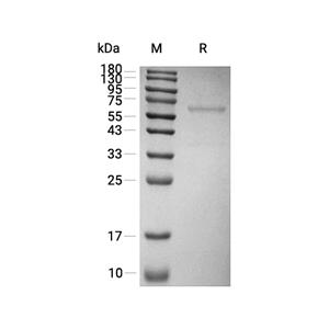 COL4A3蛋白, Rat (HEK293, Fc)