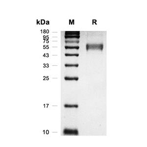 CD37蛋白, Mouse (HEK293, hFc)