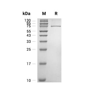 PLK1蛋白, Human (sf9, His),PLK1 Protein, Human (sf9, His)