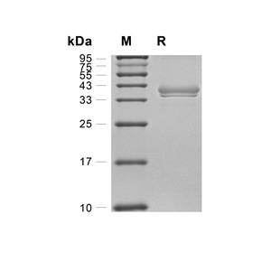 BCMA/TNFRSF17蛋白, Rhesus Macaque (HEK293, Fc),BCMA/TNFRSF17 Protein, Rhesus Macaque (HEK293, Fc)