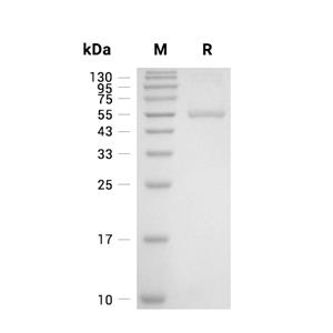 BLMH/Bleomycin Hydrolase蛋白, Mouse (His)