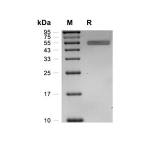 BMPR1A/ALK-3蛋白, Canine (HEK293, Fc)