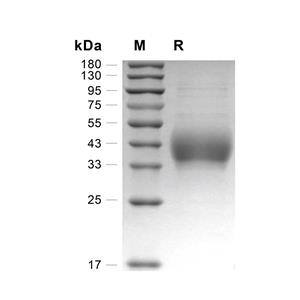 DNAM-1蛋白, Rat (HEK293, His),DNAM-1 Protein, Rat (HEK293, His)
