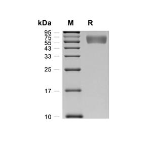 IL-1R1蛋白, Cynomolgus (HEK293, His)