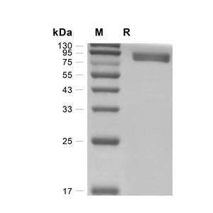 IL-1R2蛋白, Canine (HEK293, Fc),IL-1R2 Protein, Canine (HEK293, Fc)