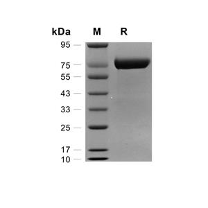 KIRREL3/NEPH2蛋白, Mouse (HEK293, His),KIRREL3/NEPH2 Protein, Mouse (HEK293, His)