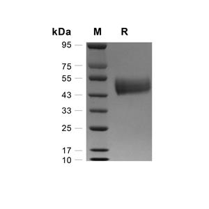 OBCAM/OPCML蛋白, Mouse (HEK293, His)