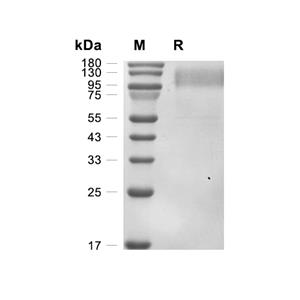 envelope glycoprotein gp120蛋白, HIV-1 (AAC31819, HEK293, His),envelope glycoprotein gp120 Protein, HIV-1 (AAC31819, HEK293, His)