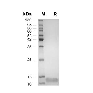Neuregulin-4/NRG4蛋白, Human