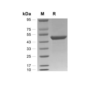 SETD7蛋白, Human (His)