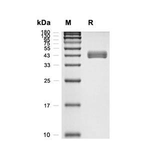 CD3E-CD3G Heterodimer蛋白, Rhesus Macaque (HEK293, Fc)