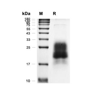 CD63蛋白, Human/Cynomolgus (HEK293, His)
