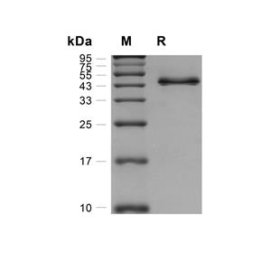 FKBP11蛋白, Human (HEK293, Fc)