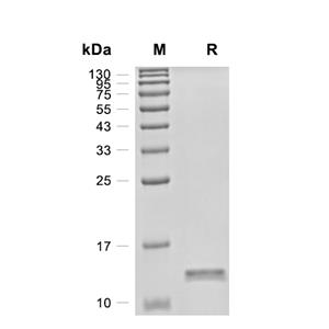 FKBP12蛋白, Mouse (His),FKBP12 Protein, Mouse (His)