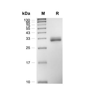 FOLR2蛋白, Human (HEK293, His)