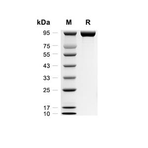 FSTL5蛋白, Human (HEK293, His)