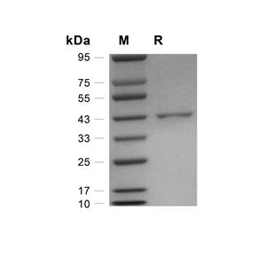 GFPT1蛋白, Human,GFPT1 Protein, Human