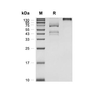 IGFBP-5蛋白, Canine (HEK293, Fc),IGFBP-5 Protein, Canine (HEK293, Fc)