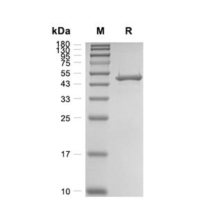 ILKAP/PP2C delta蛋白, Human (HEK293, His),ILKAP/PP2C delta Protein, Human (HEK293, His)