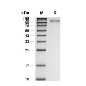 MEGF10蛋白, Human (HEK293, His)