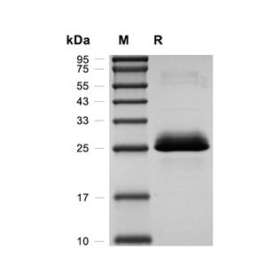 MESDC2蛋白, Human (HEK293, His),MESDC2 Protein, Human (HEK293, His)