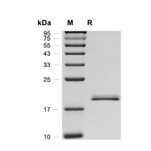 MSRB3蛋白, Human (HEK293, His),MSRB3 Protein, Human (HEK293, His)