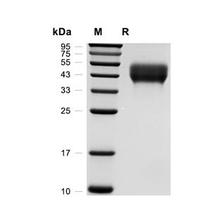 NEGR1蛋白, Human (HEK293, His)