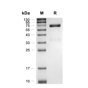 NKp46/NCR1蛋白, Rat (HEK293, Fc)