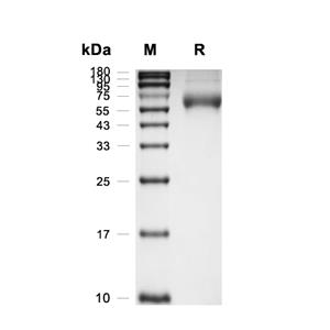 NPTXR蛋白, Human (HEK293, His),NPTXR Protein, Human (HEK293, His)