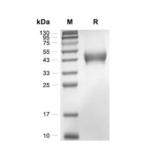 OMGP蛋白, Mouse (HEK293, His)