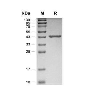 p53R2蛋白, Human (His)